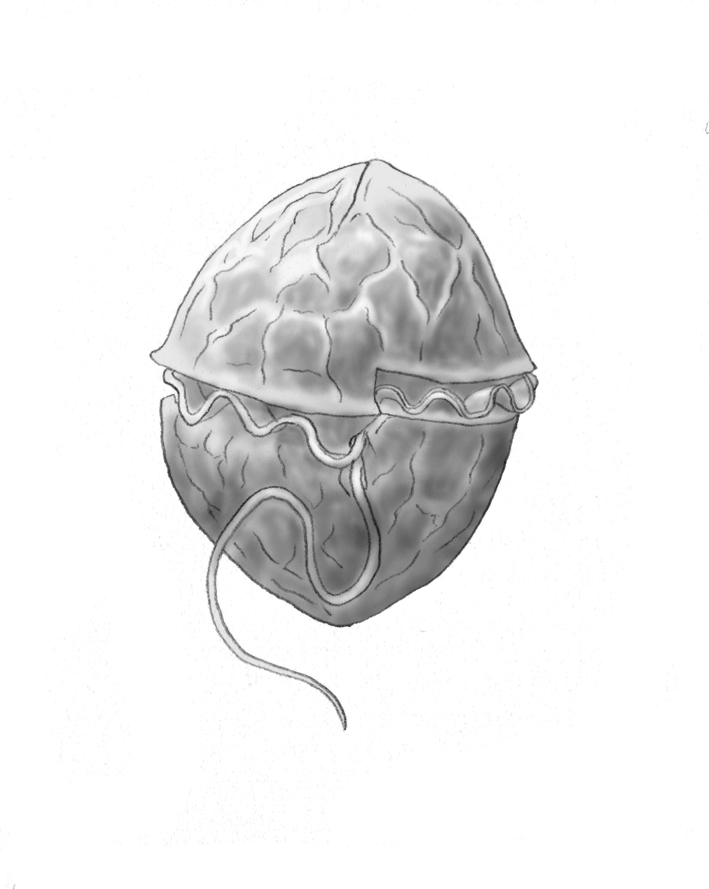 Dictyocha speculum